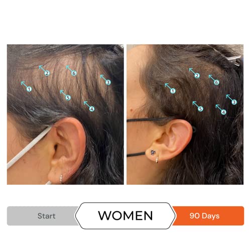 Revita Шампоан за истонченных коса от DS Laboratories - Шампоан за придаване на обем и сгъстяване на коса за мъже и жени,