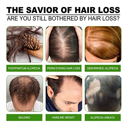 Масло за възстановяване растежа на косата с розмарин, в 30-дневен запас - Прави косата по-гъста, Укрепва Косата, Подхранва