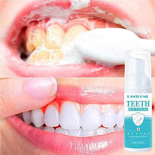 Омекотители за зъби, Премахване на зъбен камък, Избелване на зъбите, Заздравяването на Язви в устата, Премахване на лош дъх, Профилактика и лечение на кариес, Възста