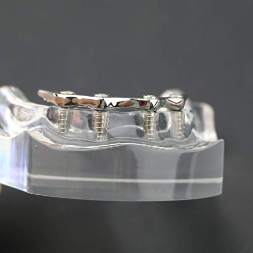 Феята на модел на зъбите Златисто-сребрист цвят Демонстрация на Практическото обучение на Демонстрация на 4 импланти (ПЛАНК