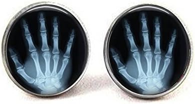 Рентгенова Снимка на Ръцете - Обеци с Овална Окачване,Рентгенова Снимка на Ръцете - Обеци С Овална окачване Жълт Цвят